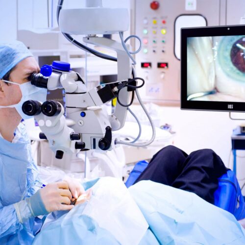 The Dos and Don’ts After Cataract Surgery