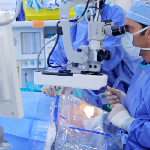 cataract surgery